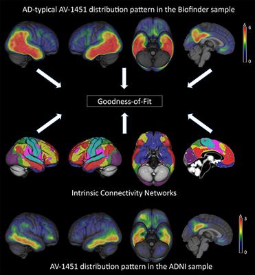 Tau Pathology Distribution in Alzheimer's disease Corresponds Differentially to Cognition-Relevant Functional Brain Networks